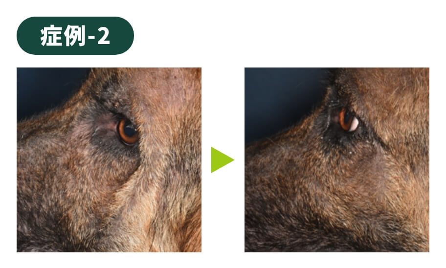 症例-2