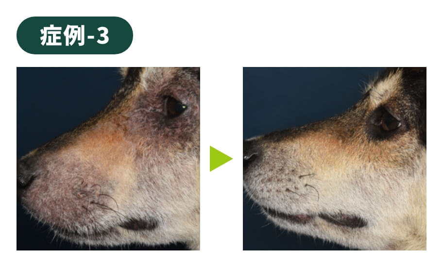 症例-3