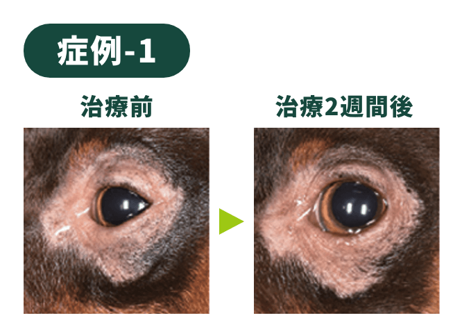 症例-1
